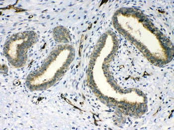 PPID Rabbit Polyclonal Antibody