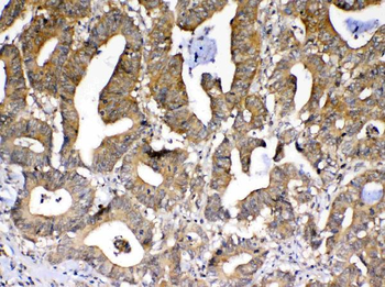 PPID Rabbit Polyclonal Antibody