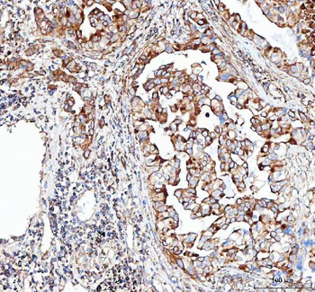 VE-Cadherin CDH5-/VE Rabbit Polyclonal Antibody