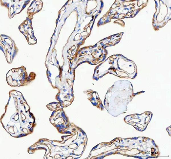 VE-Cadherin CDH5-/VE Rabbit Polyclonal Antibody
