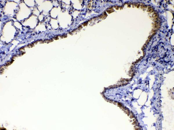 HE4/Wfdc2 Rabbit Polyclonal Antibody