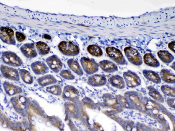 HE4/Wfdc2 Rabbit Polyclonal Antibody
