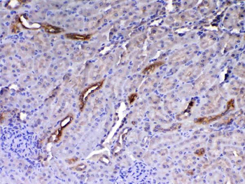 HE4/Wfdc2 Rabbit Polyclonal Antibody