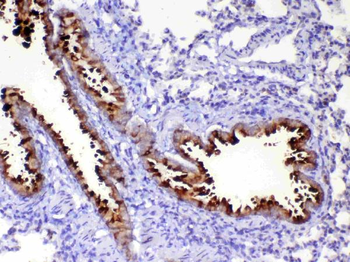 HE4/Wfdc2 Rabbit Polyclonal Antibody
