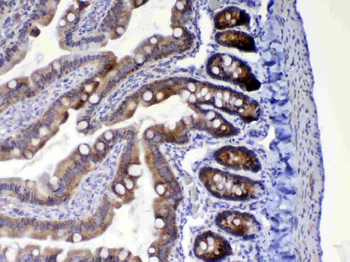 HE4/Wfdc2 Rabbit Polyclonal Antibody