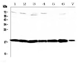 HE4/Wfdc2 Rabbit Polyclonal Antibody