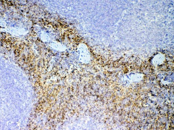 NAP2/Ppbp Rabbit Polyclonal Antibody