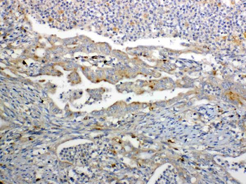 GALNS Rabbit Polyclonal Antibody