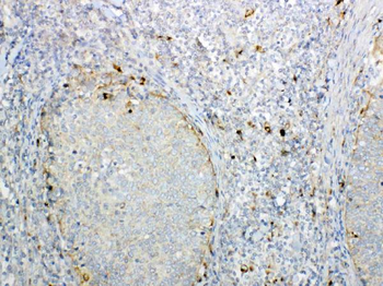 GALNS Rabbit Polyclonal Antibody