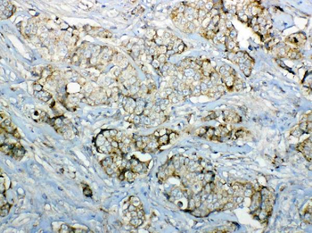 GALNS Rabbit Polyclonal Antibody
