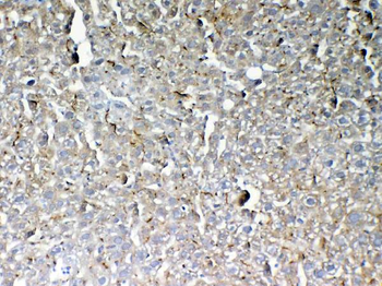 GALNS Rabbit Polyclonal Antibody