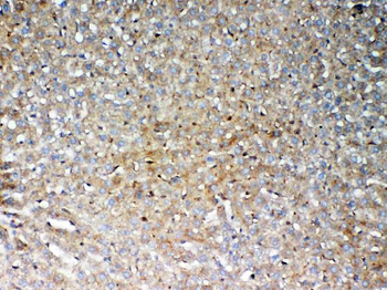 GALNS Rabbit Polyclonal Antibody