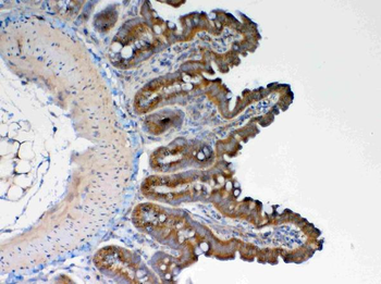 GALNS Rabbit Polyclonal Antibody