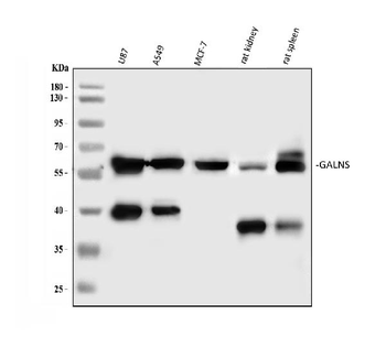 GALNS Rabbit Polyclonal Antibody