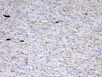 GAD65/GAD2 Rabbit Polyclonal Antibody