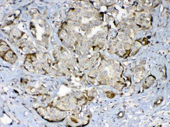 GAD65/GAD2 Rabbit Polyclonal Antibody
