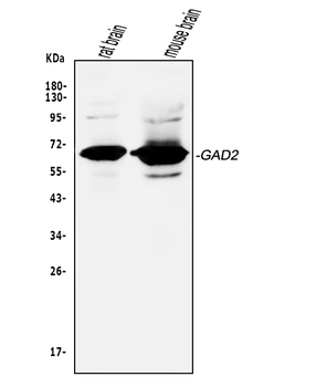 GAD65/GAD2 Rabbit Polyclonal Antibody