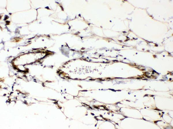 Cyclophilin B/PPIB Rabbit Polyclonal Antibody