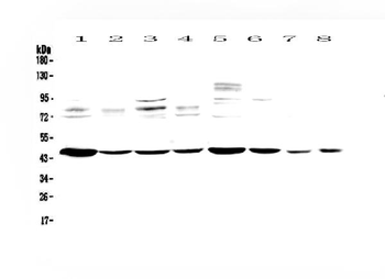 PDK2 Rabbit Polyclonal Antibody