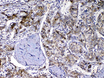 Vitamin D Binding protein/GC Rabbit Polyclonal Antibody