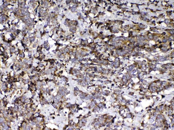 Vitamin D Binding protein/GC Rabbit Polyclonal Antibody