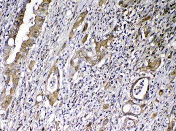Vitamin D Binding protein/GC Rabbit Polyclonal Antibody