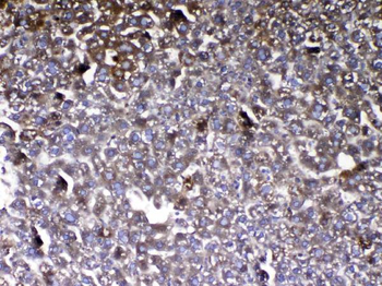 Vitamin D Binding protein/GC Rabbit Polyclonal Antibody