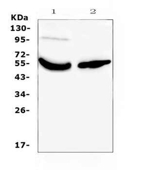 Vitamin D Binding protein/GC Rabbit Polyclonal Antibody