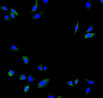 Calpain 2/CAPN2 Rabbit Polyclonal Antibody