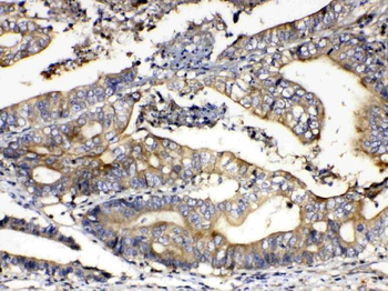 Calpain 2/CAPN2 Rabbit Polyclonal Antibody