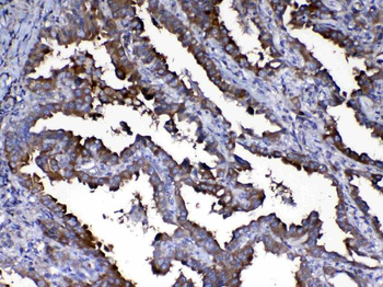 Calpain 2/CAPN2 Rabbit Polyclonal Antibody