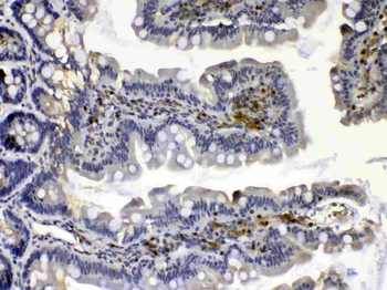 Calpain 2/CAPN2 Rabbit Polyclonal Antibody
