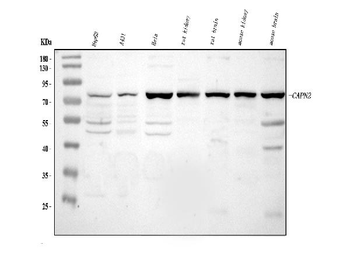 Calpain 2/CAPN2 Rabbit Polyclonal Antibody