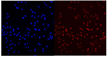 MED15 Rabbit Polyclonal Antibody