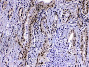 MED15 Rabbit Polyclonal Antibody