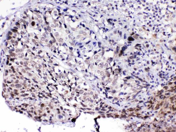 MED15 Rabbit Polyclonal Antibody
