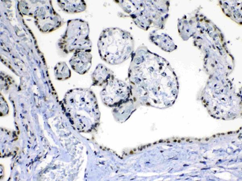 MED15 Rabbit Polyclonal Antibody