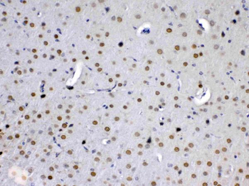 MED15 Rabbit Polyclonal Antibody