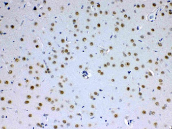 MED15 Rabbit Polyclonal Antibody