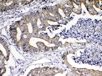 TNFSF18 Rabbit Polyclonal Antibody