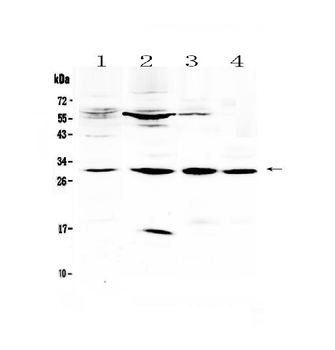 VEGFB Rabbit Polyclonal Antibody