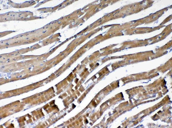 VEGFB Rabbit Polyclonal Antibody