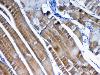 VEGFB Rabbit Polyclonal Antibody