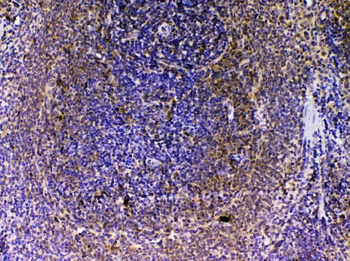 VEGFB Rabbit Polyclonal Antibody