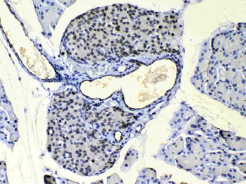 COPE Rabbit Polyclonal Antibody
