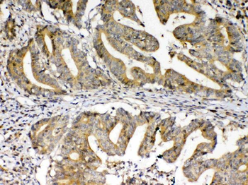 FZD3 Rabbit Polyclonal Antibody