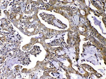 MMP16 Rabbit Polyclonal Antibody