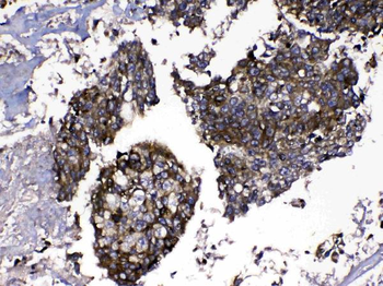 MMP16 Rabbit Polyclonal Antibody