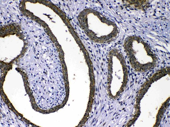 MMP16 Rabbit Polyclonal Antibody