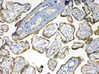 MMP16 Rabbit Polyclonal Antibody